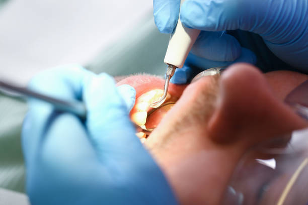 Best Pediatric Emergency Dentist in New Whiteland, IN