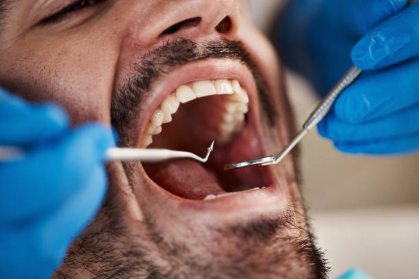 Best Urgent Dental Care for Toothache in New Whiteland, IN