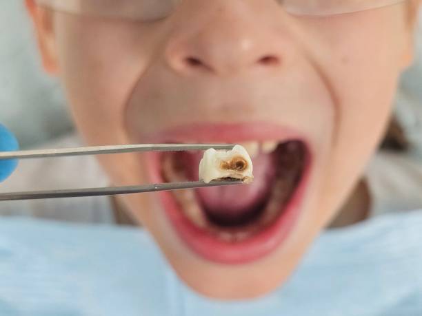 Best Emergency Dentist for Special Needs Patients in New Whiteland, IN