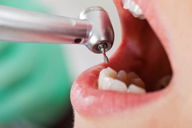 Best Weekend Emergency Dentist in New Whiteland, IN